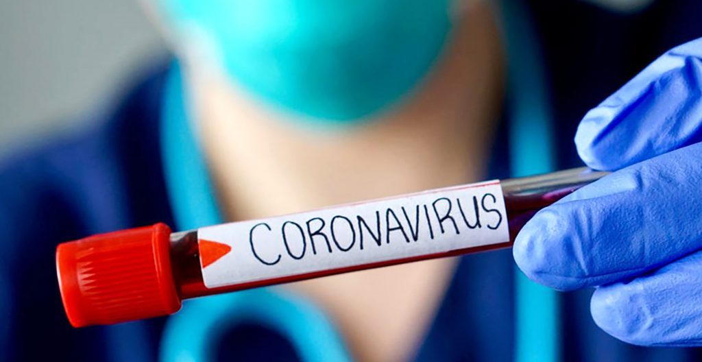/seremi-de-salud-confirmo-12-nuevos-casos-de-covid-19
