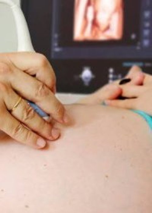 Proyecto de ley busca exigir escuchar latidos fetales antes de acceder al aborto en dos causales legales